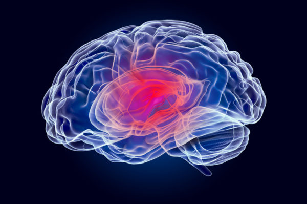 Brain disease concept graphic